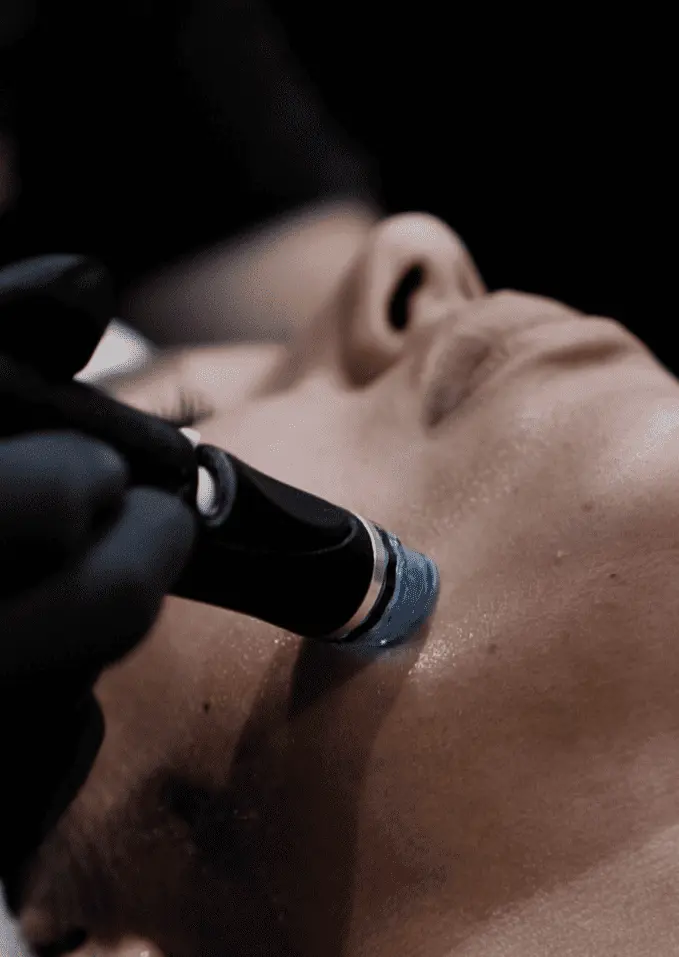 Hydrafacial - Clinic 26